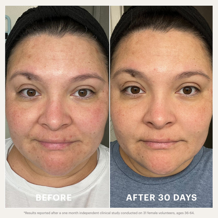 Glo Skin Beauty Renew Serum