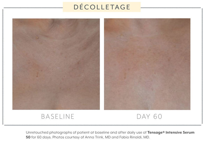 Biopelle Tensage Intensive Serum 50 10x Tubes