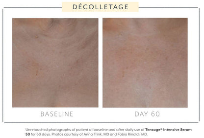 Biopelle Tensage Intensive Serum 50 10x Tubes