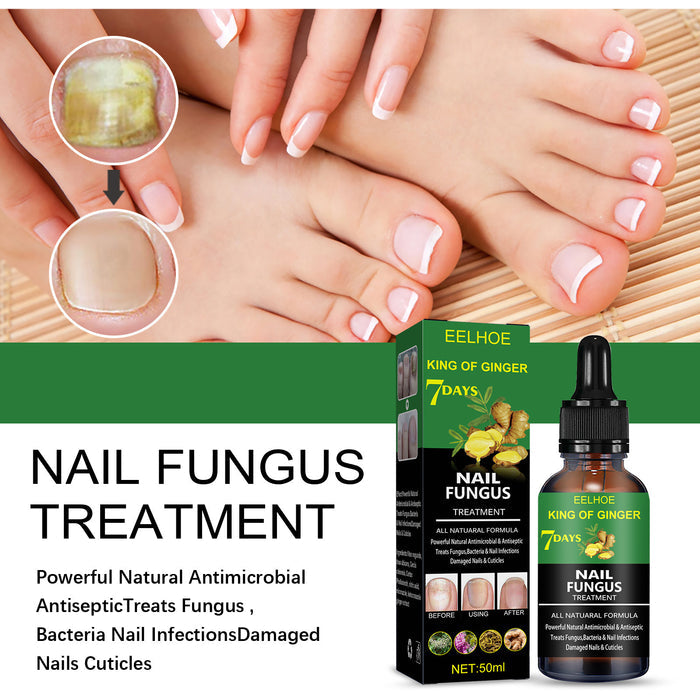 Eelhoe Nail Fungus Treatment Repair Solution – Effective Care for Hands, Feet, and Nails EELHOE COSMETICS
