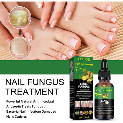 Eelhoe Nail Fungus Treatment Repair Solution – Effective Care for Hands, Feet, and Nails EELHOE COSMETICS