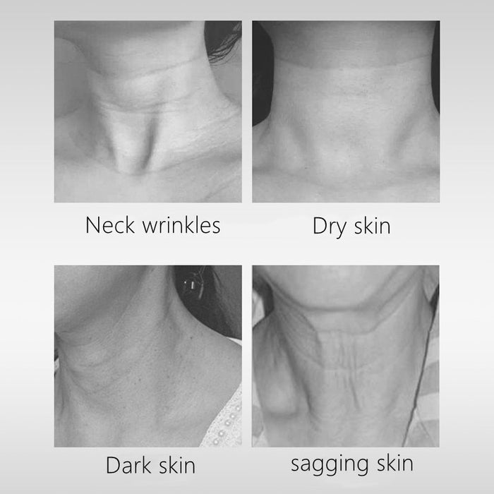 EELHOE Neck Massager – Ultrasonic Color Light Skin Rejuvenation Device EELHOE COSMETICS
