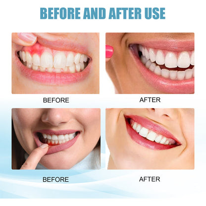 EELHOE Oral Cleaning Gum Care Hyaluronic Acid Toothpaste EELHOE COSMETICS