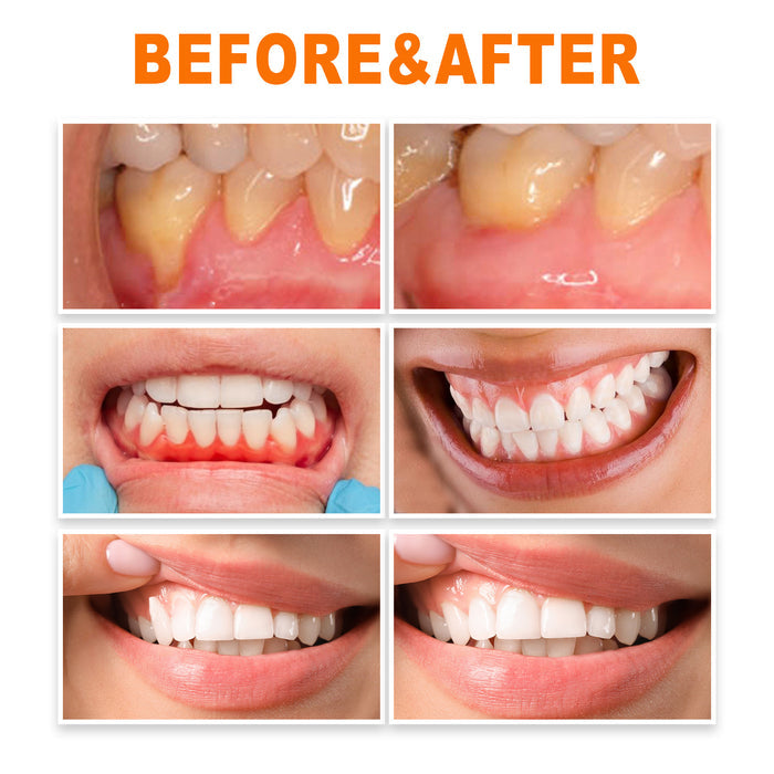 EELHOE Teeth Repair & Deep Cleaning – Whitening & Gum Care Solution EELHOE COSMETICS