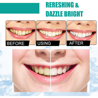 EELHOE Teeth Whitening Powder – Deep Cleaning & Stain Removal EELHOE COSMETICS