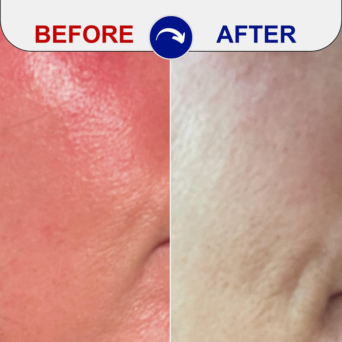 before and after skincare results showing improved skin texture