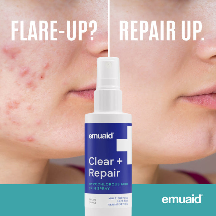 Emuaid Clear + Repair skin spray bottle with before and after acne treatment on a person's face.