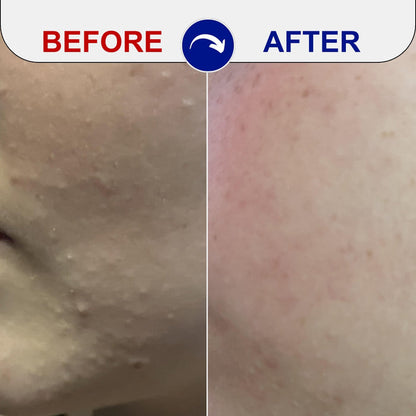 before and after skincare treatment results