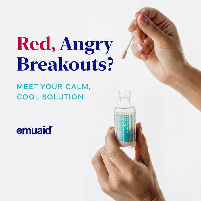 Hand holding acne treatment with a dropper, promoting emuaid for 'Red, Angry Breakouts'.