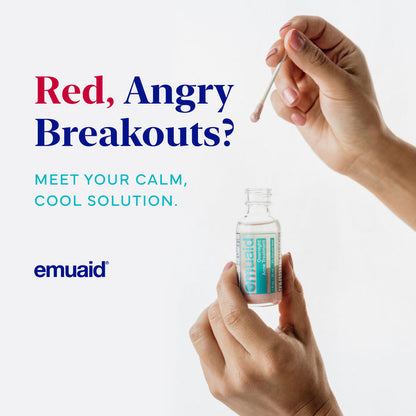 Hand holding acne treatment with a dropper, promoting emuaid for 'Red, Angry Breakouts'.