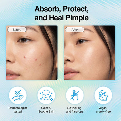 Freego Hydrocolloid Pimple Patch 120pcs
