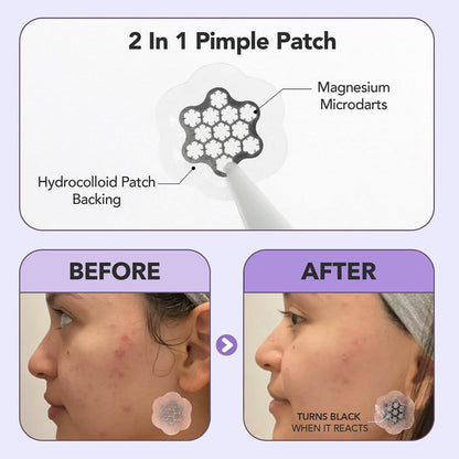 Freego Magnesium Microdarts Pimple Patch