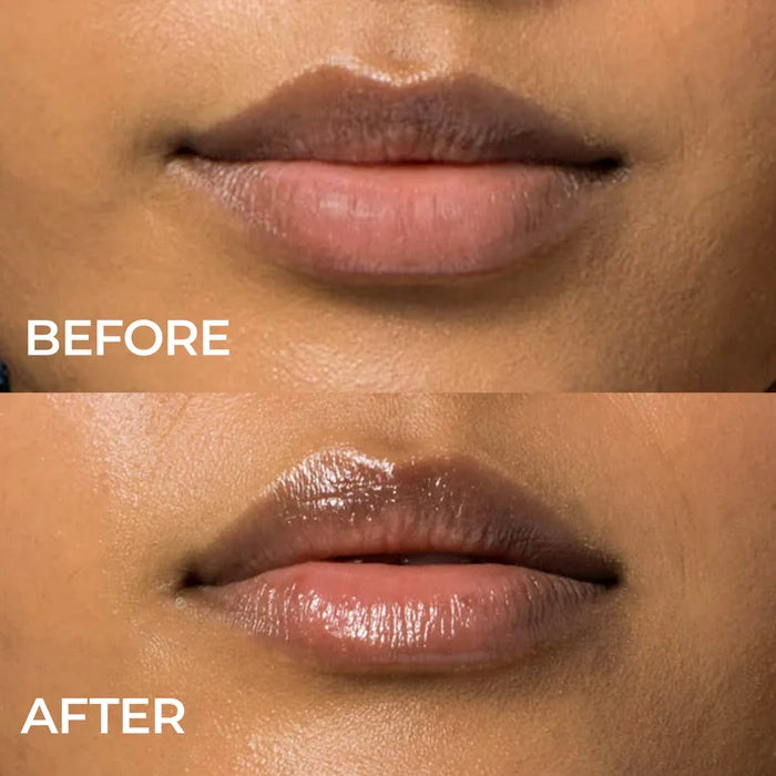 Indie Lee-Lip Remedy Mask-Skincare-01.2026_IL_LipRemedyMask_PDP_2050x2050_W-BA-The Detox Market |