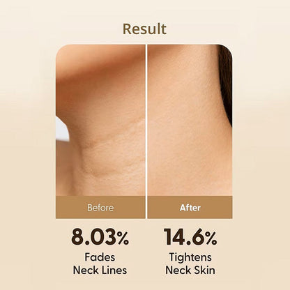 PEPTIDE VOLUME NECK AND FACE CREAM- Crema Premium Dedicata Zonei Gatului Pentru Fermitate Cu Aplicator