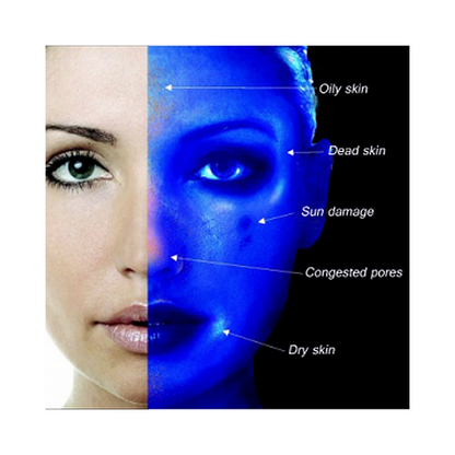 Wood's Lamp Ultraviolet Skin Diagnosis Tool