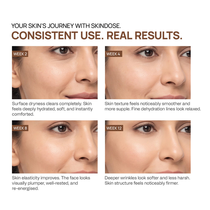 Yuderma Skindose Time Filler
