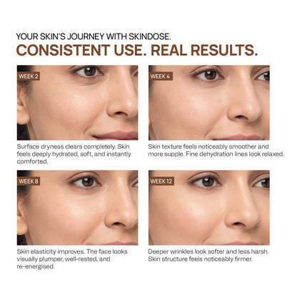 Yuderma Skindose Time Filler